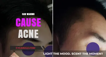 Can Waxing Trigger Acne? Understanding Skin Reactions Post-Waxing