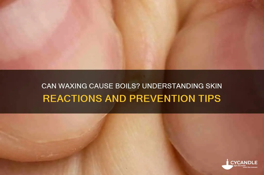 can waxing cause boils