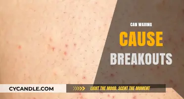 Can Waxing Cause Breakouts? Understanding Skin Reactions Post-Waxing