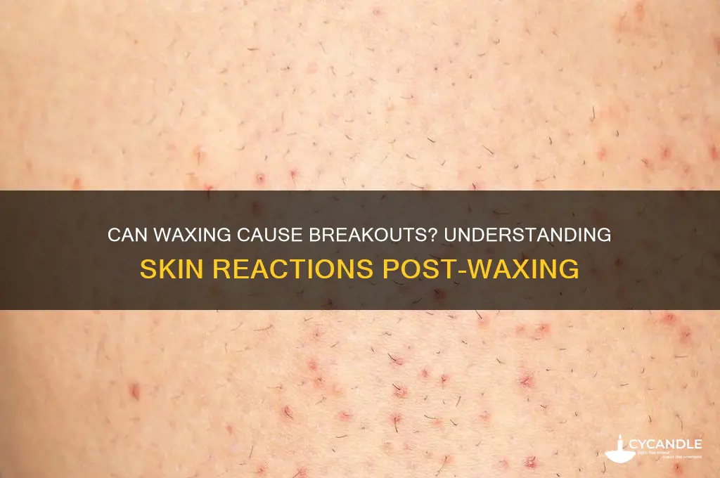 can waxing cause breakouts