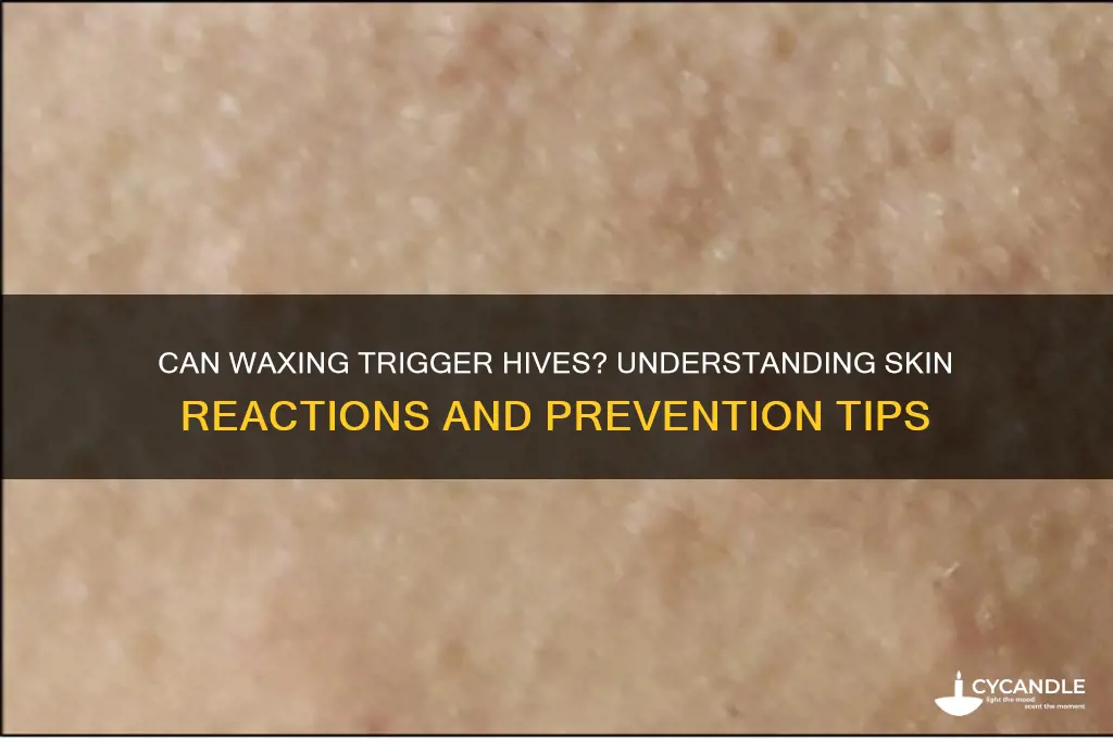 can waxing cause hives