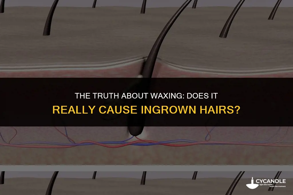 can waxing cause ingrown hair