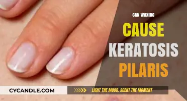 Can Waxing Trigger Keratosis Pilaris? Understanding the Skin Connection