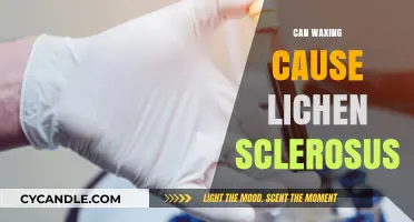 Can Waxing Trigger Lichen Sclerosus? Understanding the Potential Link