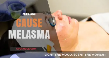 Can Waxing Trigger Melasma? Understanding Skin Risks and Prevention