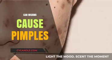 Can Waxing Cause Pimples? Understanding Post-Wax Skin Reactions