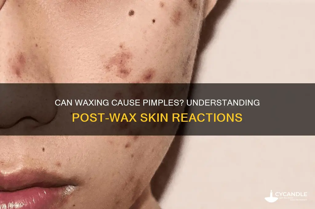 can waxing cause pimples