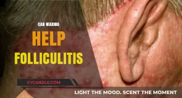 Can Waxing Help Folliculitis? Benefits, Risks, and Expert Tips