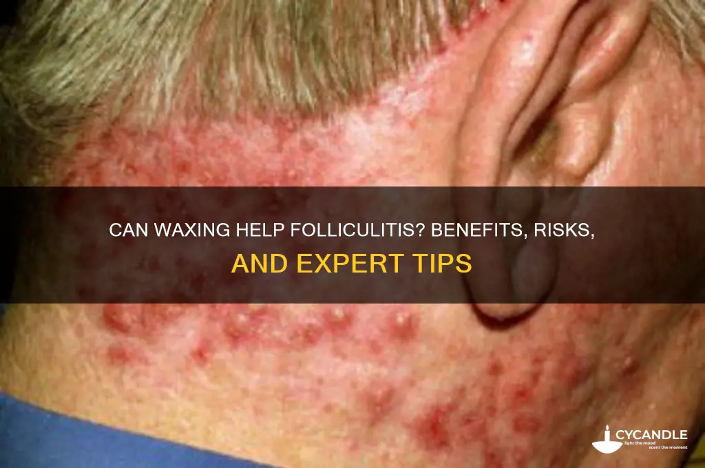 can waxing help folliculitis