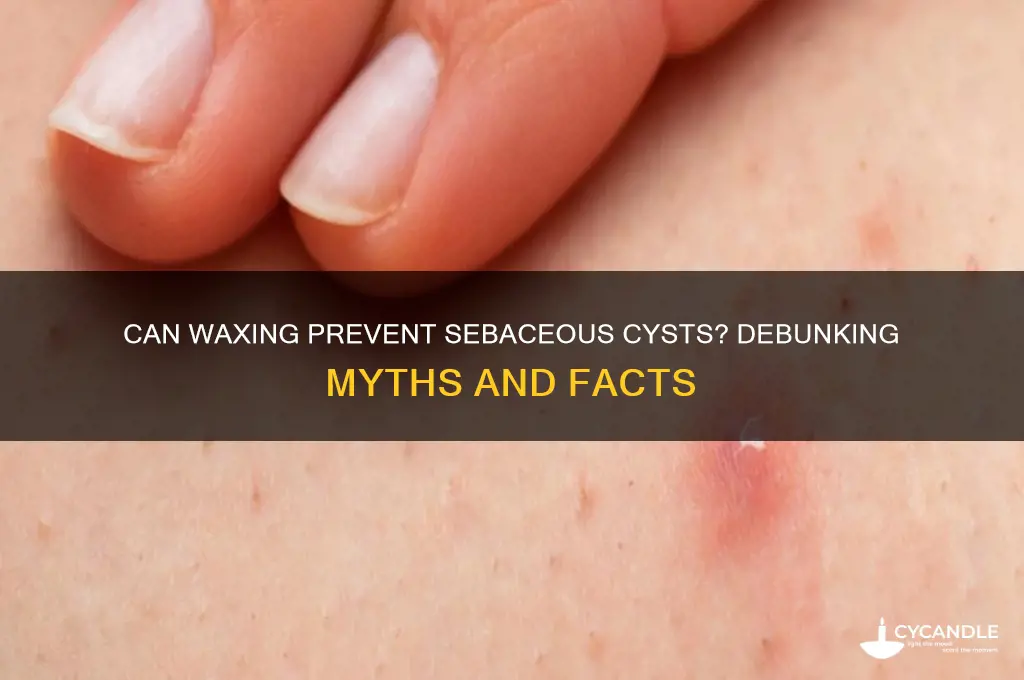 can waxing prevent sebaceous cysts