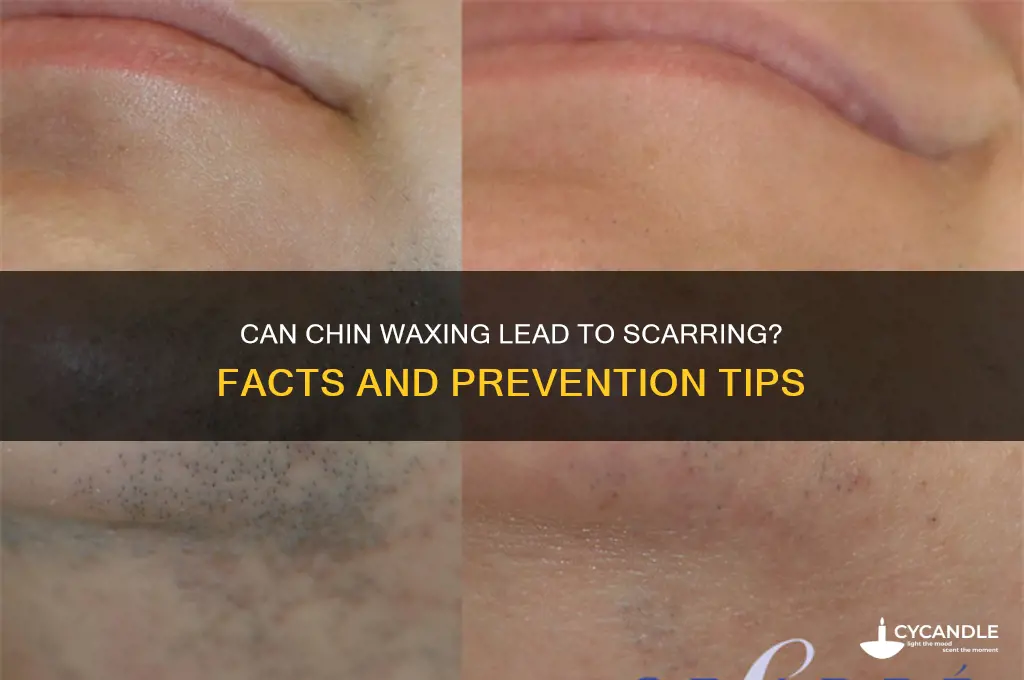 can waxing your chin cause scarring