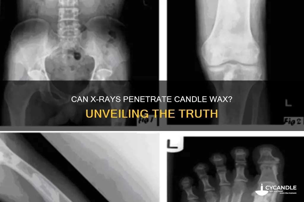 can x ray see through candle wax