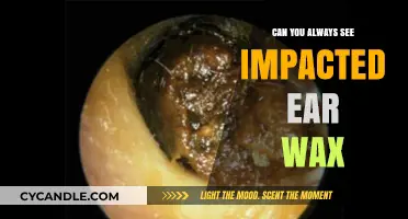 Can You Always Spot Impacted Ear Wax? A Clear Guide