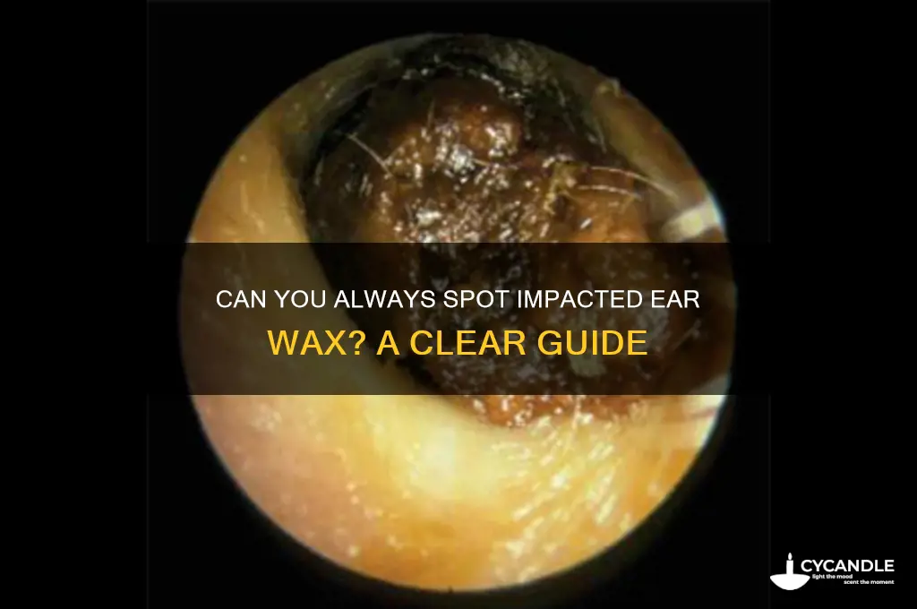 can you always see impacted ear wax