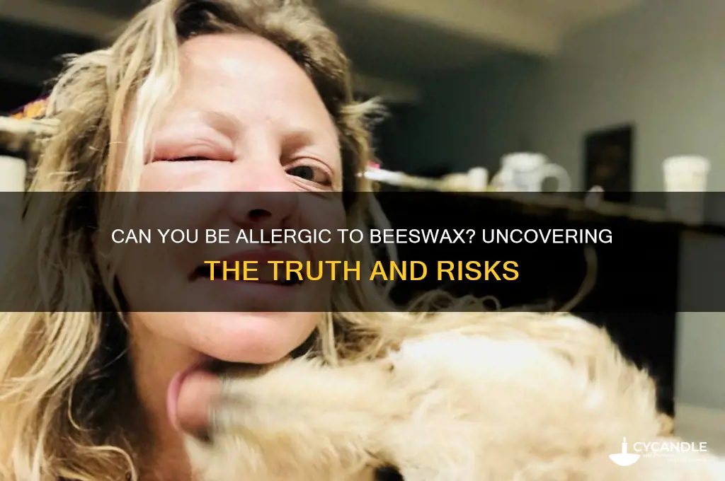 can you be allergic to bees wax