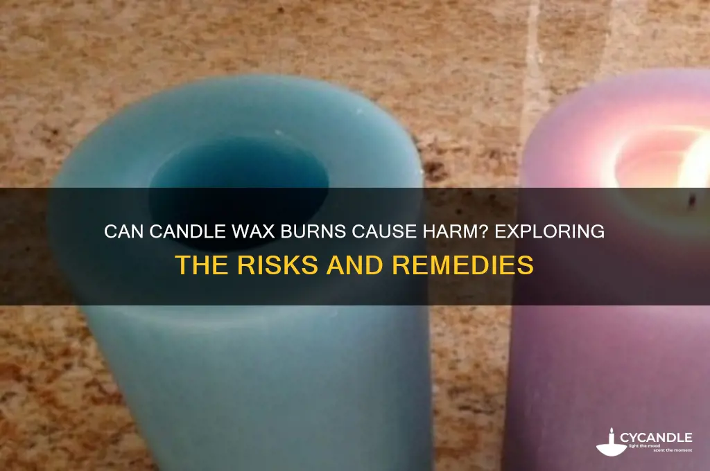 can you burn yourself with candle wax