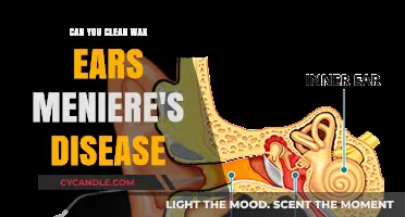 Cleaning Ear Wax Safely with Meniere's Disease: Tips and Precautions