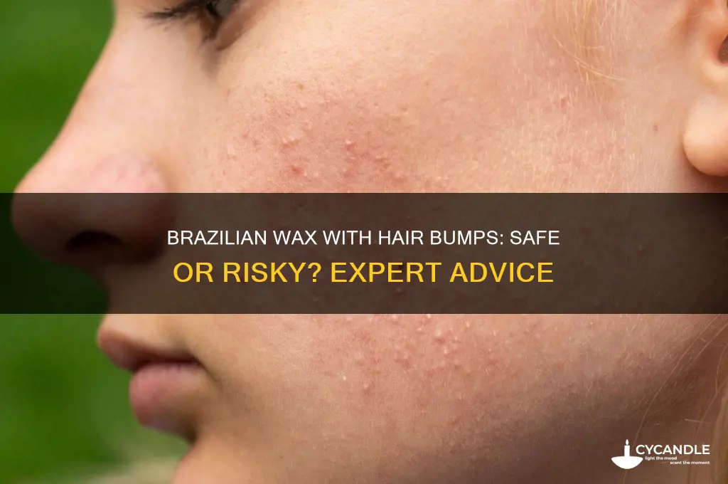 can you get a brazilian wax with a hair bump