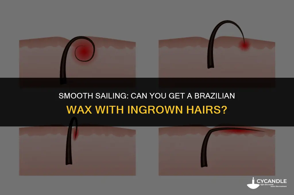 can you get a brazilian wax with ingrown hairs