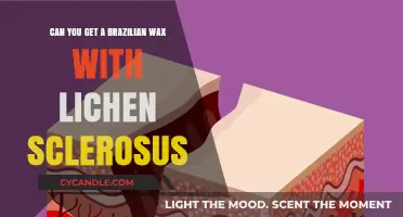 Brazilian Wax and Lichen Sclerosus: Safe or Risky Choice?