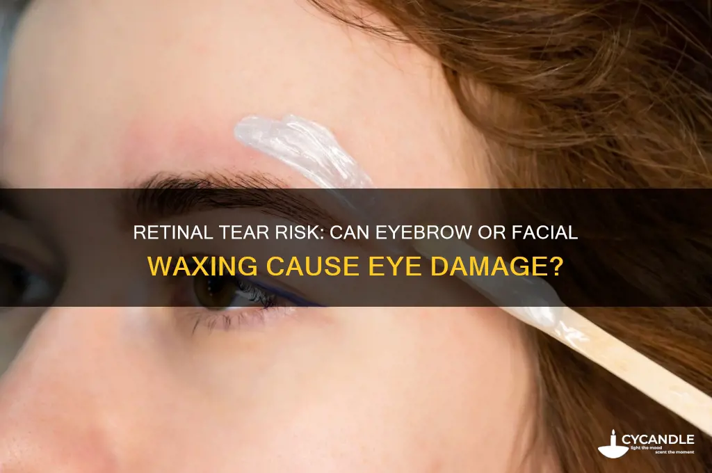 can you get a retinal tear from waxing