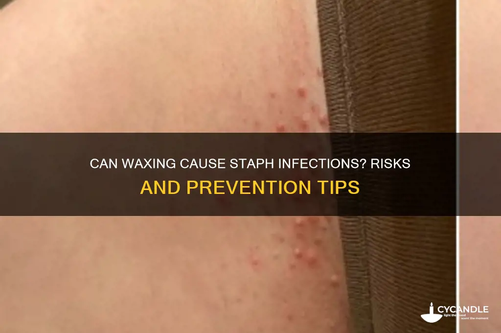 can you get a staph infection from waxing