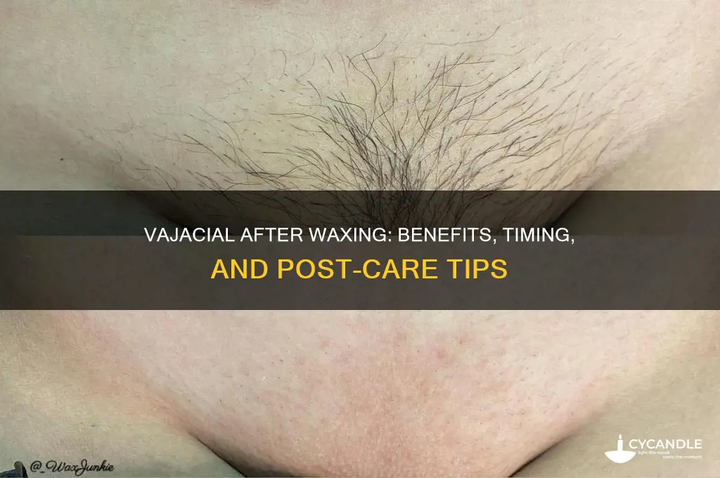 can you get a vajacial after waxing