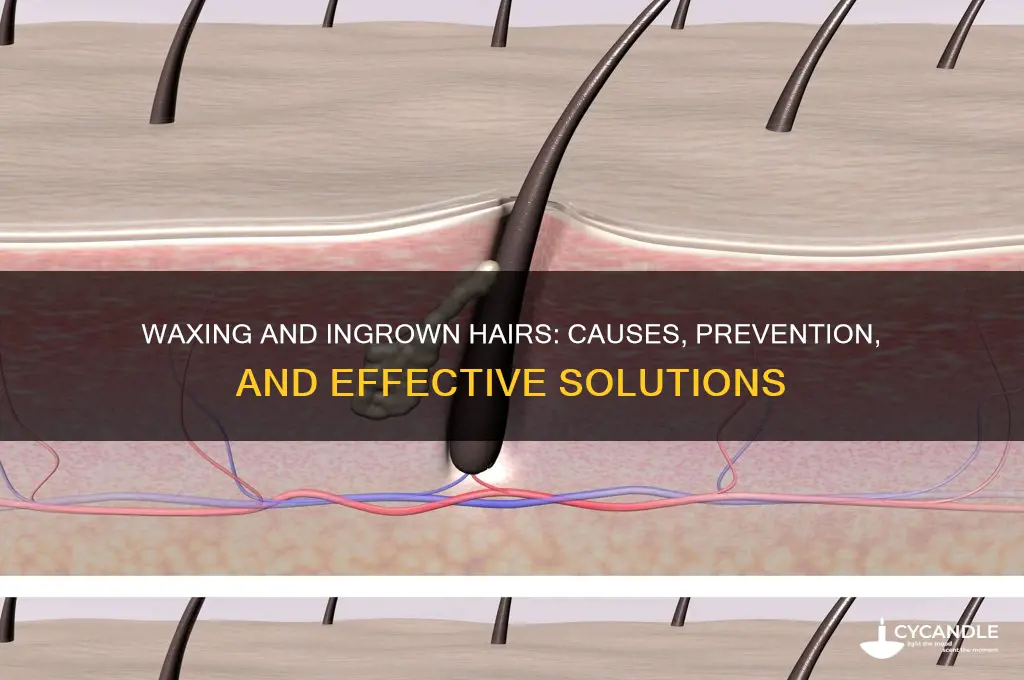 can you get an ingrown hair from waxing