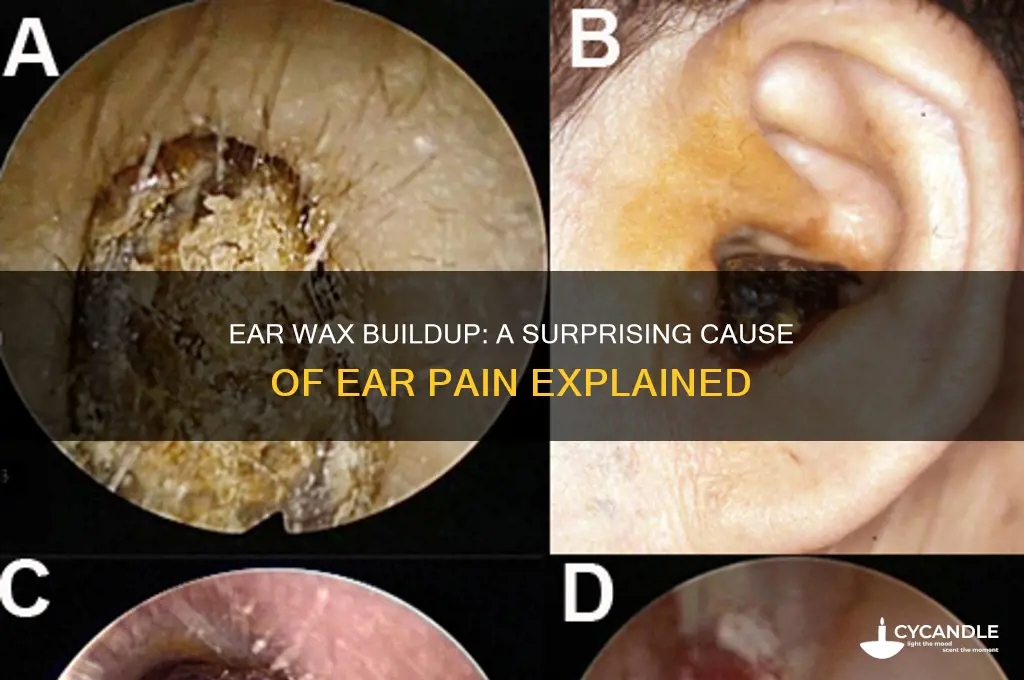 can you get ear pain from ear wax