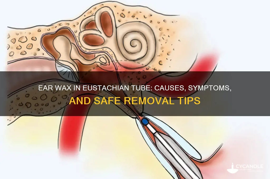 can you get ear wax in your eustachian tube