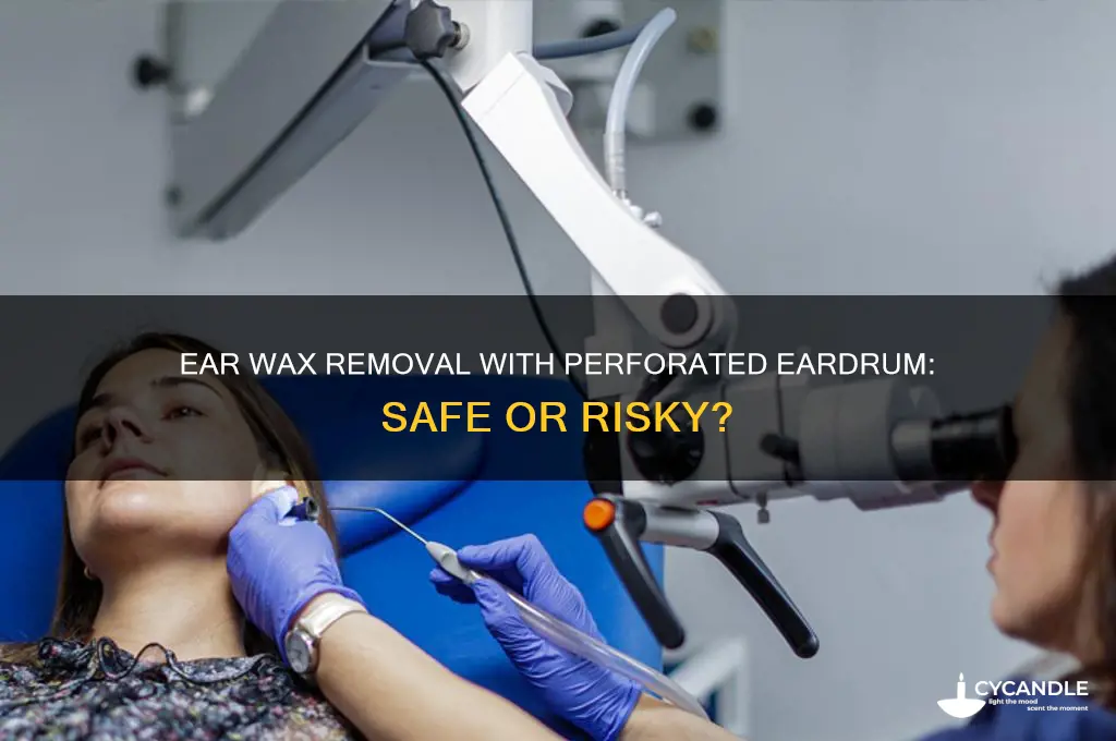 can you get ear wax removed with ear drum perforation
