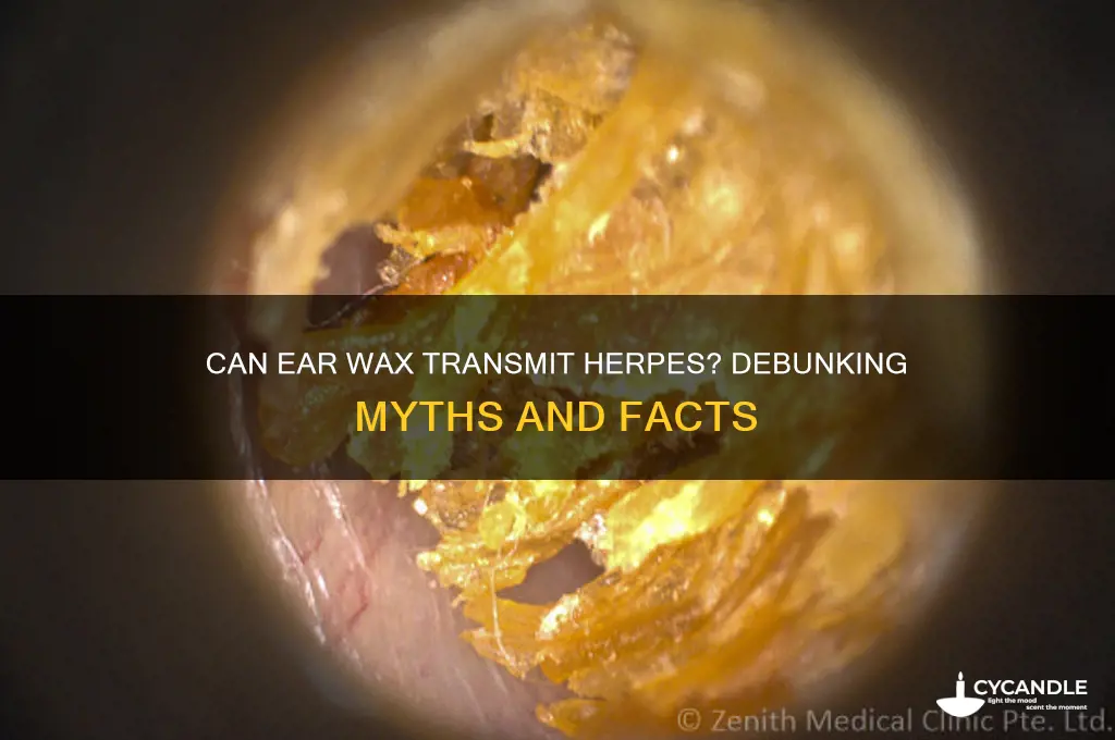 can you get herpes from ear wax
