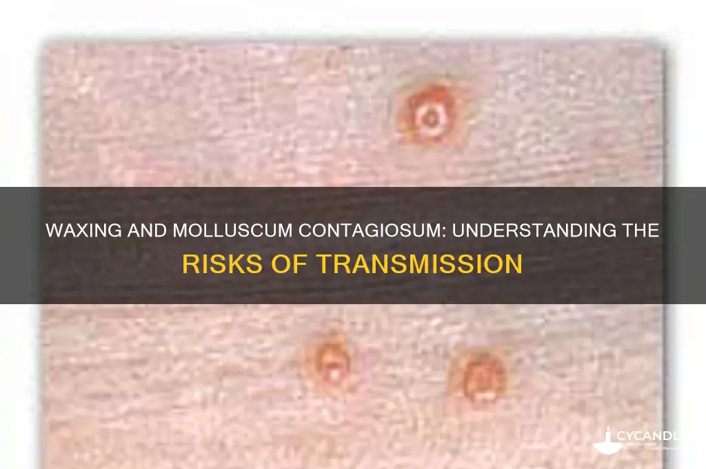 can you get molluscum contagiosum from waxing