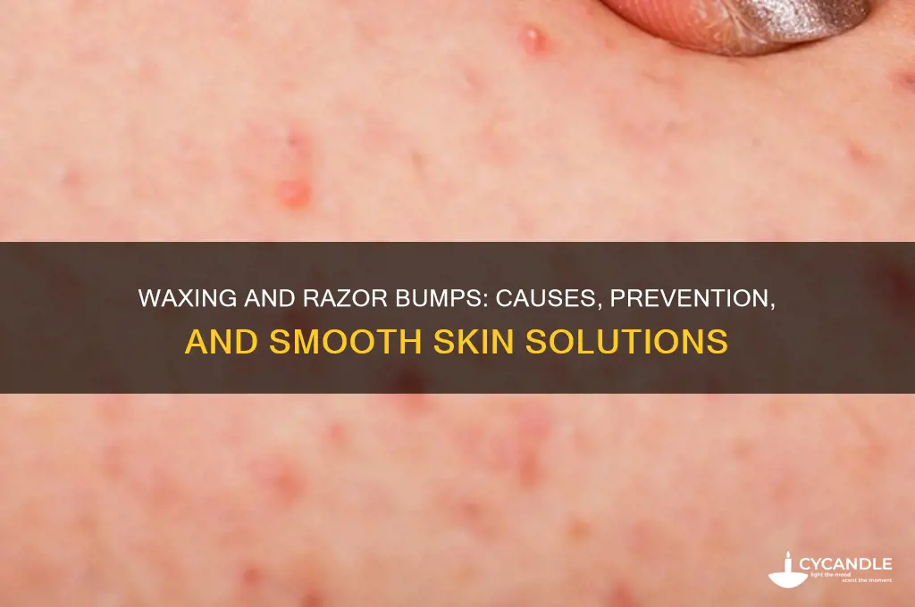 can you get razor bumps from waxing