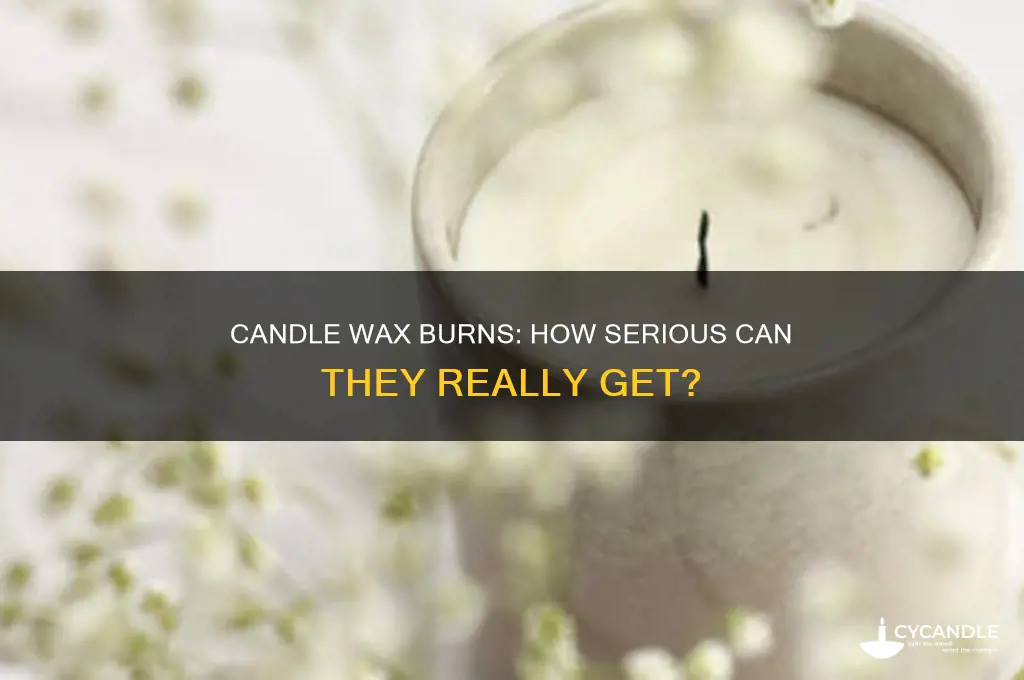 can you get serious burns with candle wax