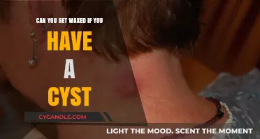 Waxing with Cysts: Safe or Risky? Expert Advice Revealed