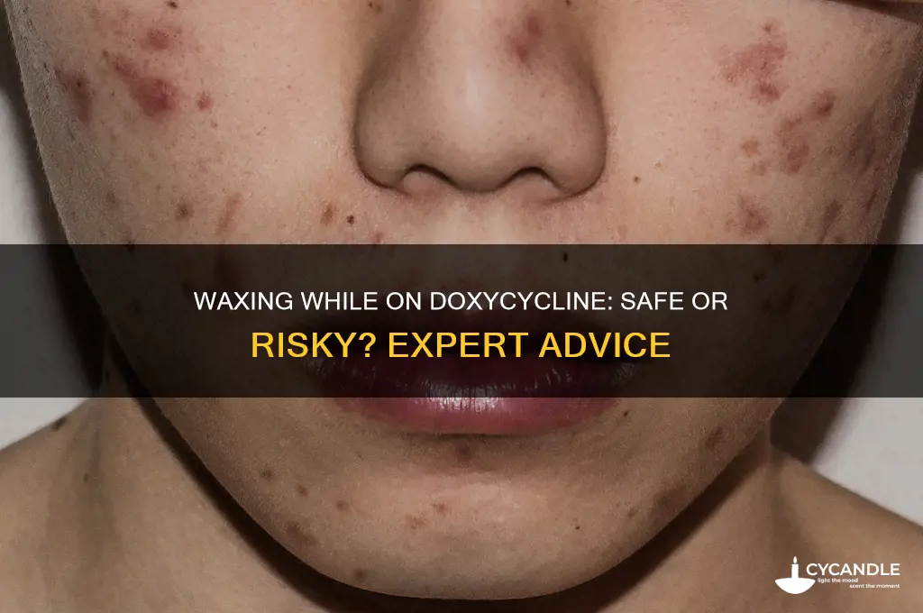 can you get waxed on doxycycline