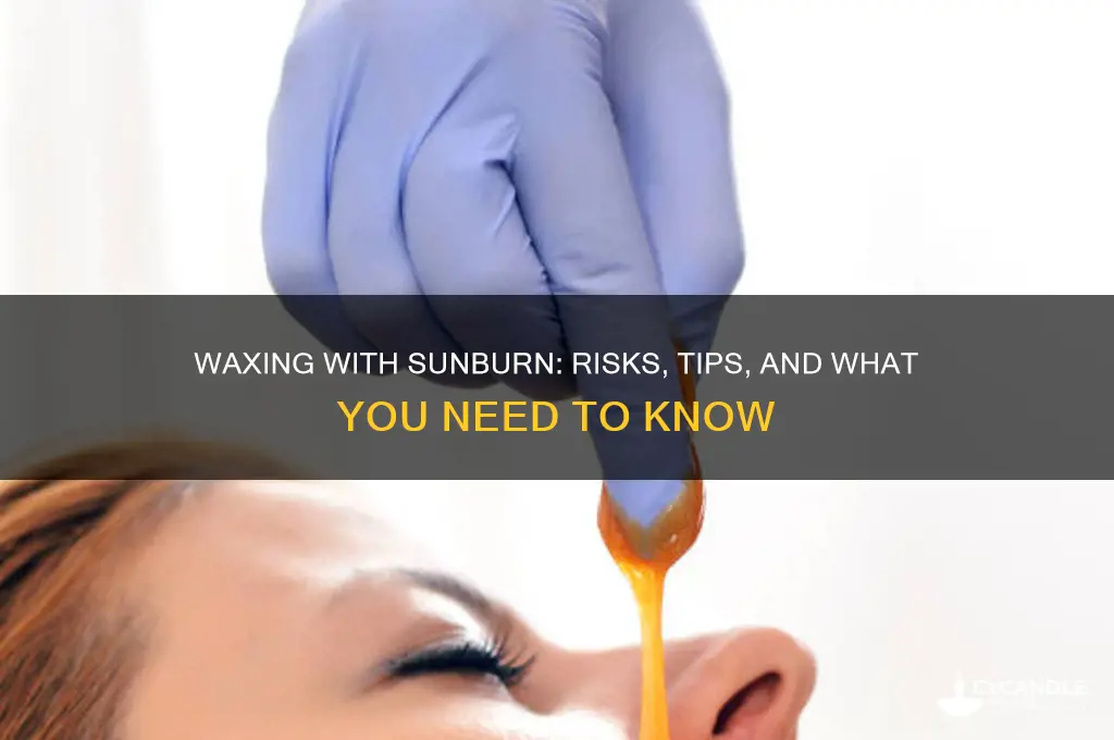 can you get waxed with a sunburn