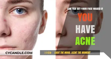 Facial Waxing with Acne: Safe Practice or Skin Risk?