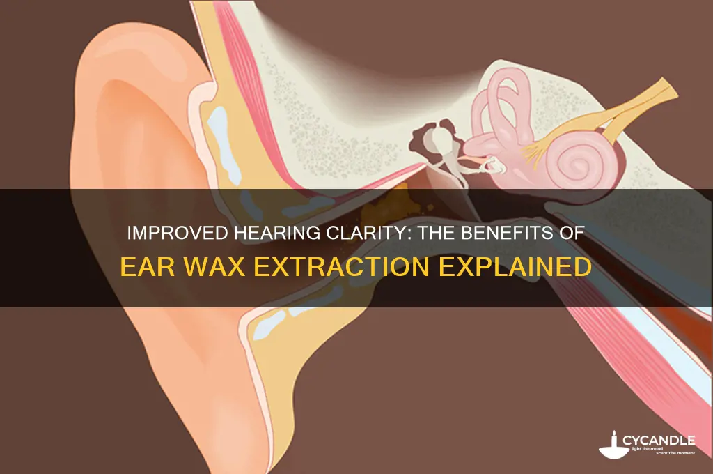 can you hear better after ear wax extraction
