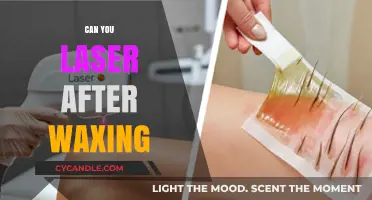Laser After Waxing: Safe Timing and Skin Care Tips