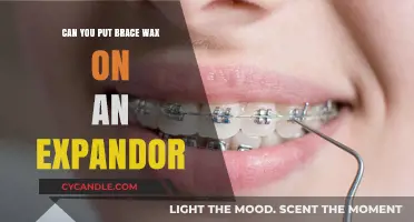 Can You Use Brace Wax on an Expander? Dental Care Tips