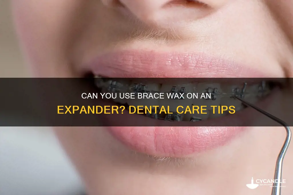 can you put brace wax on an expandor