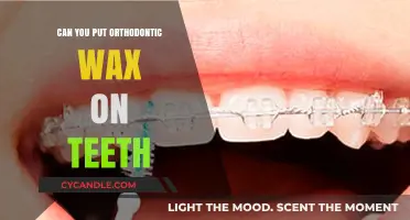 Using Orthodontic Wax on Teeth: Safety, Benefits, and Proper Application Tips