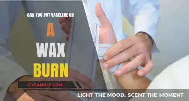 Vaseline for Wax Burns: Safe Remedy or Risky Solution?