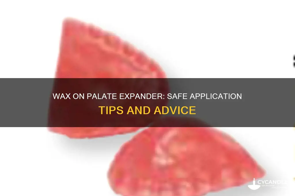 can you put wax on a palate expander
