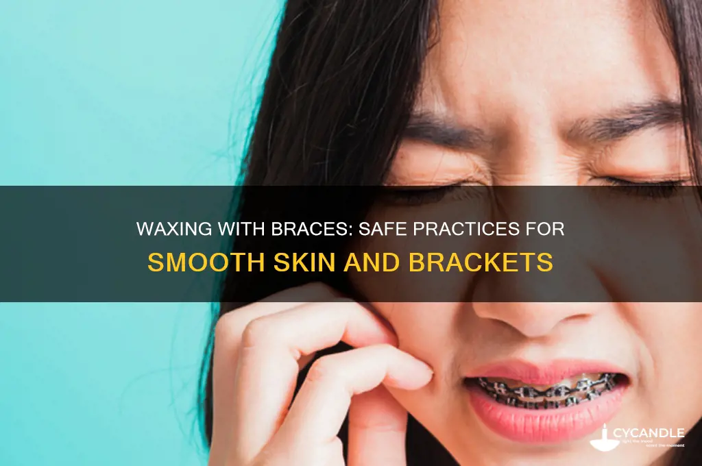 can you put wax on brackets