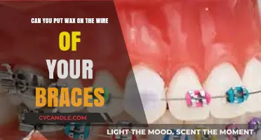 Wax on Braces Wires: Safe Solution or Orthodontic Mistake?