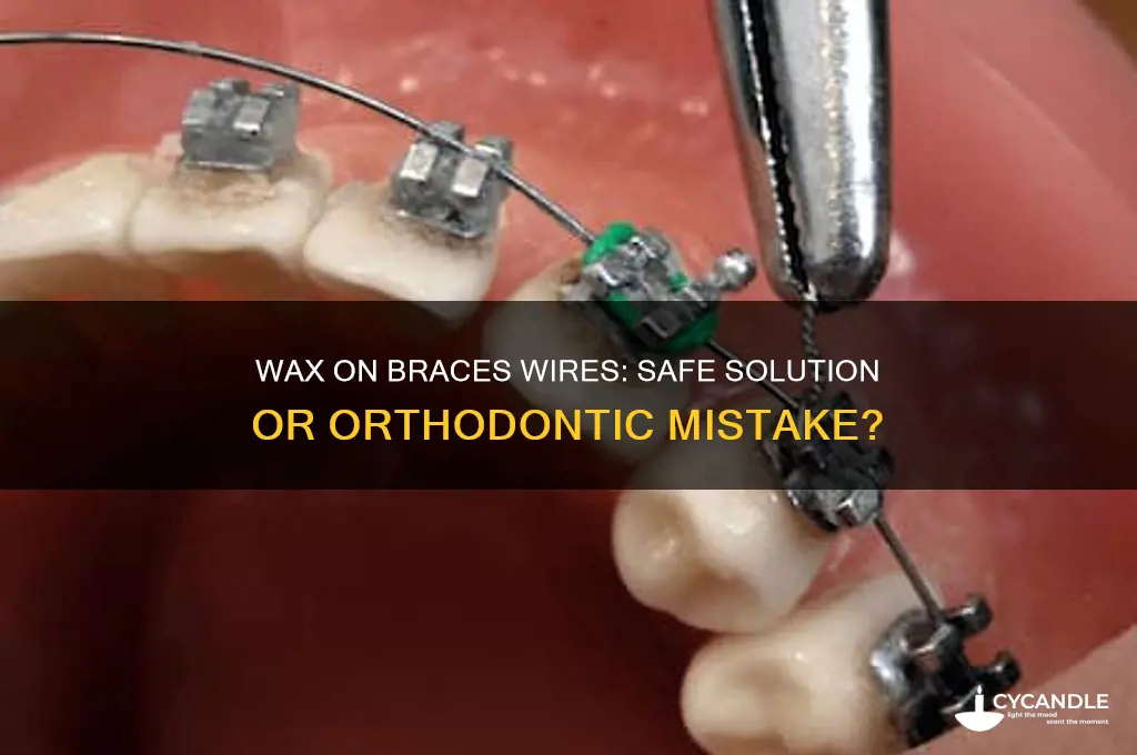 can you put wax on the wire of your braces
