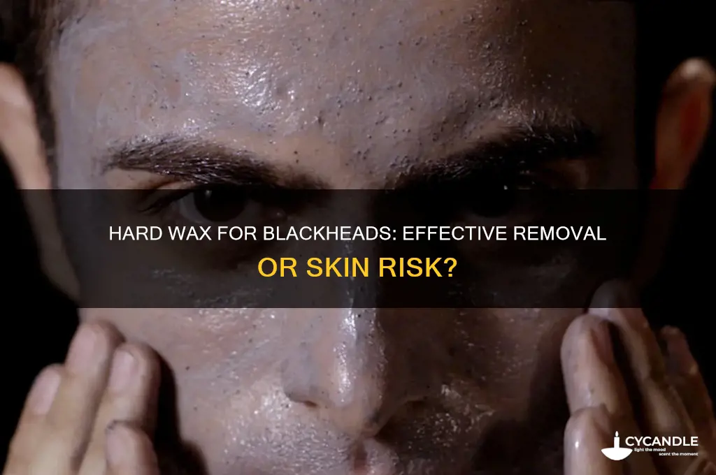 can you remove blackheads with hard wax